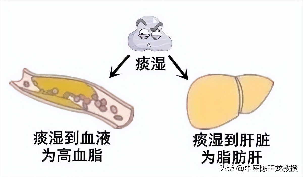 能减肥的中药配方_中医减肥祖方_枳术汤治疗肥胖