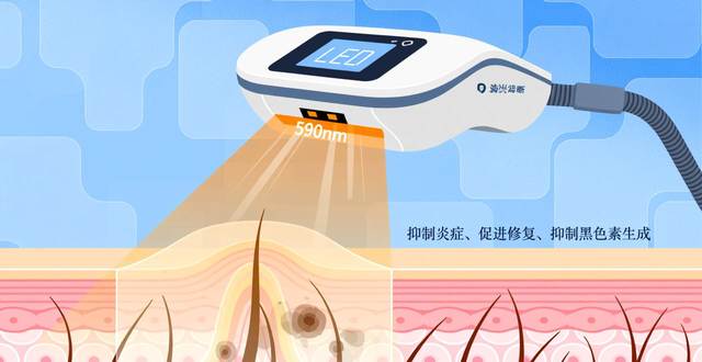 想祛黄褐斑?了解中医病因病机,避开常见鉴别误区