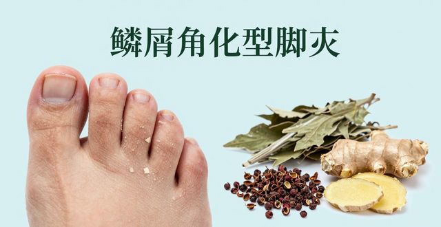 夏天脚趾缝痒有怪味?可能是脚气!教你中药泡脚配方搞定
