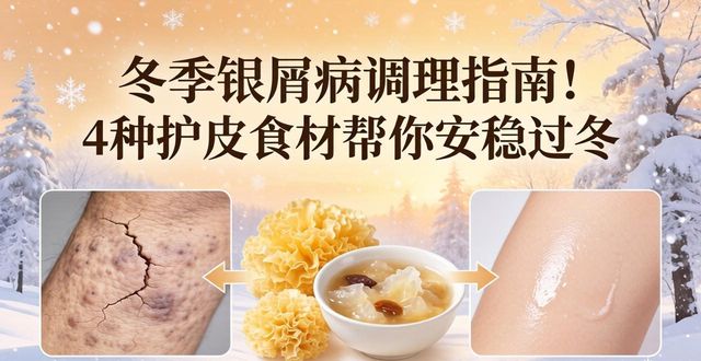 冬季银屑病调理指南！4种护皮食材帮你安稳过冬