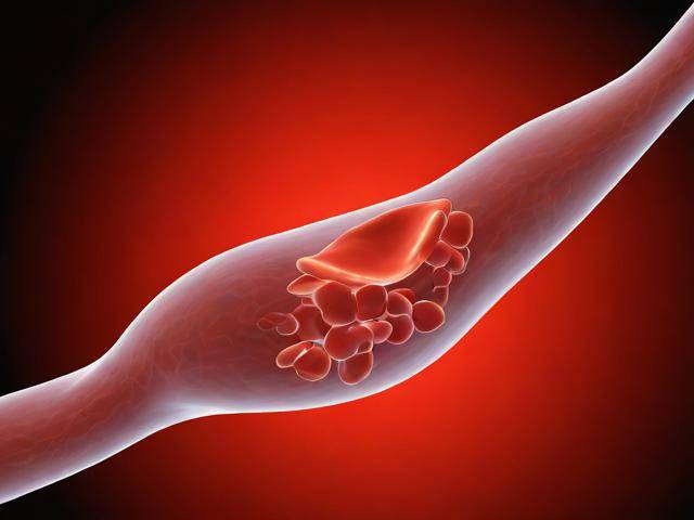 乳腺结节吃中药能散吗「乳腺结节吃中药能不能散结」