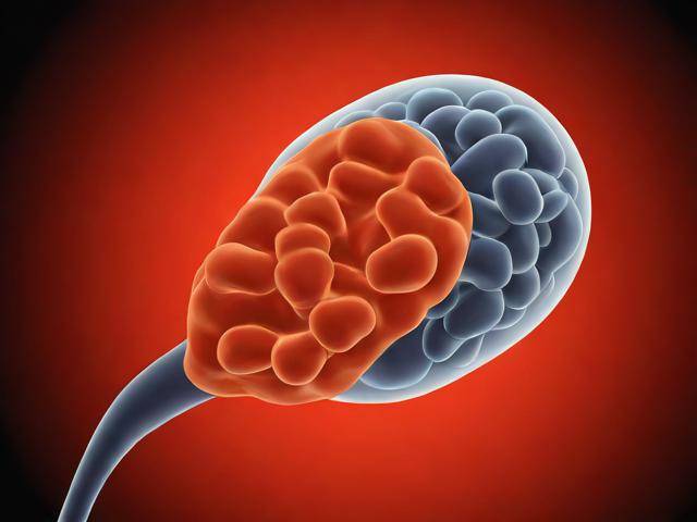 腔隙性脑梗塞吃啥中药「腔隙性脑梗塞中药秘方」