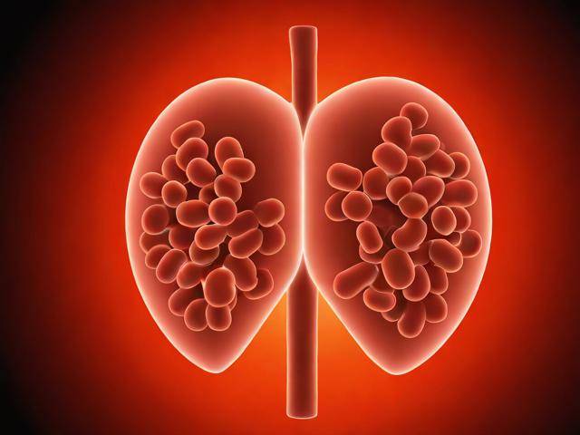 肾结石吃中药有用吗「肾结石吃中药可以好吗」